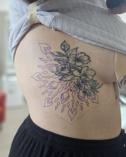 Cover Up Vorher 2